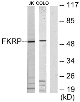 FKRP rabbit pAb