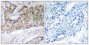 DHRS11 antibody