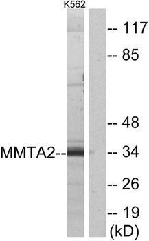 MMTAG2 rabbit pAb Antibody