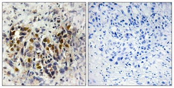 IRX3 antibody