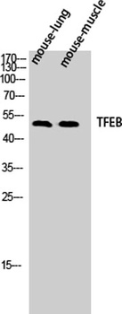 TFEB antibody