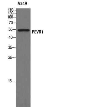 GPR172A rabbit pAb