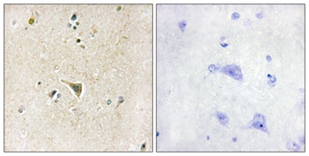 LRRK1 rabbit pAb Antibody