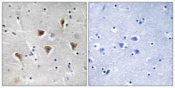 mTERF antibody