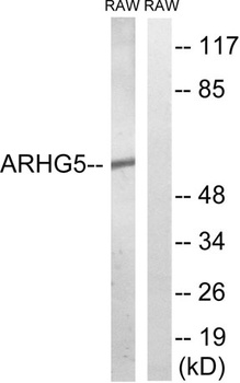 Oncogene TIM rabbit pAb