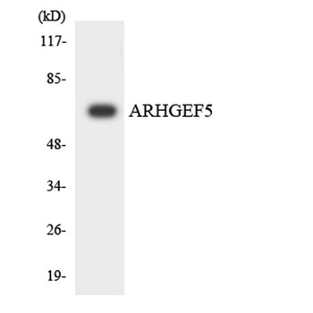 Oncogene TIM rabbit pAb Antibody
