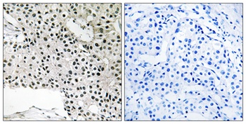 TCEAL4 antibody