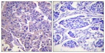 Caldesmon rabbit pAb Antibody