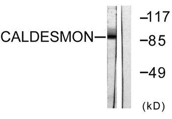 Caldesmon rabbit pAb Antibody