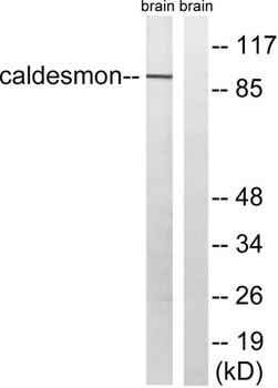 Caldesmon rabbit pAb