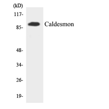 Caldesmon rabbit pAb Antibody