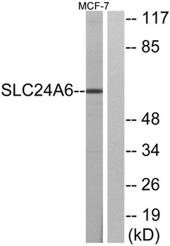 NCKX6 antibody