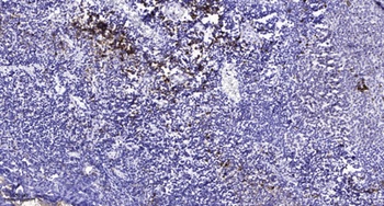 Cubilin rabbit pAb