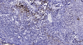 Cubilin antibody