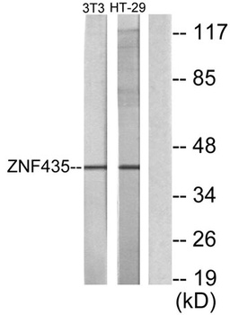 ZSCAN16 antibody