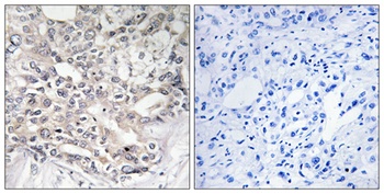 ApoL5 rabbit pAb Antibody