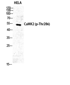 CaMKII alpha/delta (phospho-Thr286) antibody