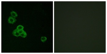 CaMKII alpha/delta antibody