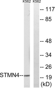 RB3 antibody