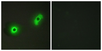 Cables2 antibody