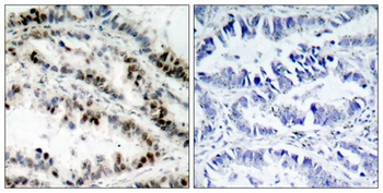 SMC1 (phospho Ser957) rabbit pAb