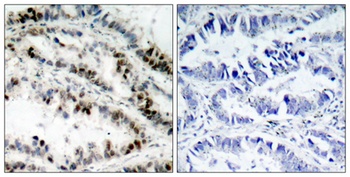 SMC1 (phospho-Ser957) antibody