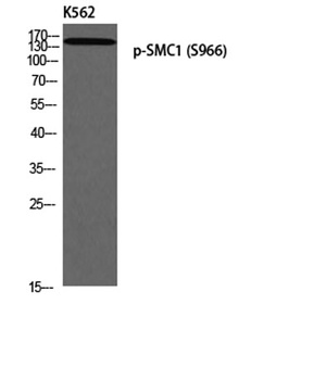 SMC1 (phospho-Ser966) antibody