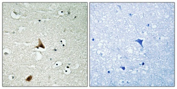 Caspase-1 (phospho-Ser376) antibody