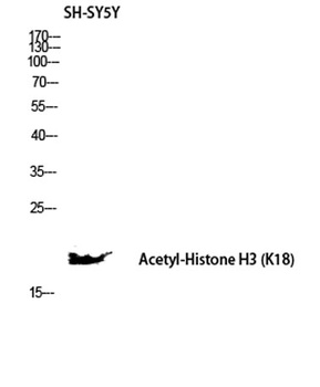 Histone H3 (Acetyl Lys18) antibody