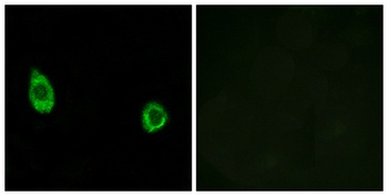 CHST9 antibody