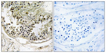 Dynein LC 2B rabbit pAb