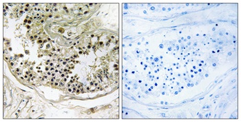 Dynein LC 2B antibody