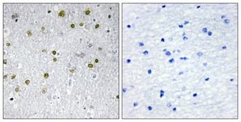 NRIP2 antibody