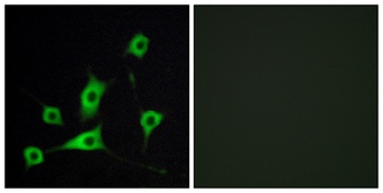 CRBP-III rabbit pAb