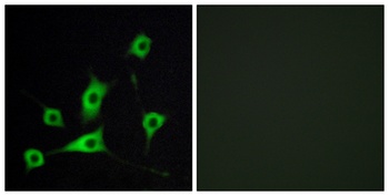 CRBP-III antibody