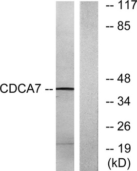 CdcA7 antibody