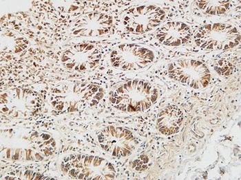 Reg IV rabbit pAb