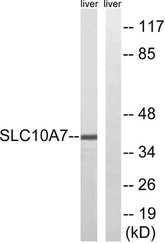 SLC10A7 antibody