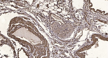 SLC10A7 rabbit pAb Antibody