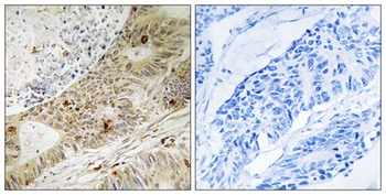 ATRIP (phospho Ser224) rabbit pAb