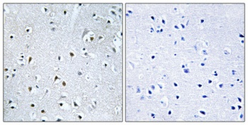 POLDIP3 rabbit pAb