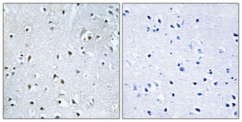 POLDIP3 antibody