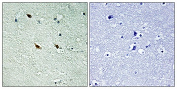 NIFK (phospho Thr234) rabbit pAb
