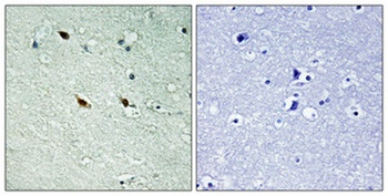 NIFK (phospho-Thr234) antibody