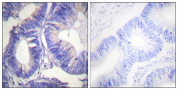 Nck-2 rabbit pAb