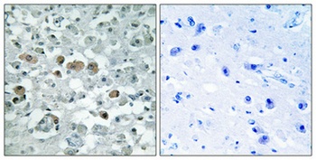 GNPAT antibody