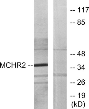 MCH-2R antibody