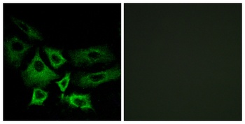 NT5C1A rabbit pAb Antibody