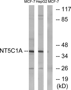 NT5C1A rabbit pAb Antibody