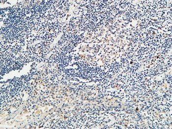 KiSS-1R rabbit pAb Antibody